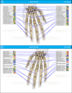 Hand Bones Skeleton Scan Report 