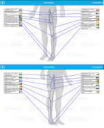 Leg Nerves Frequency Scan Report